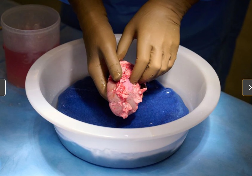 10 20 pig kidney transplant 2