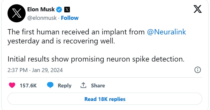 2024 01 30 Musk X 1