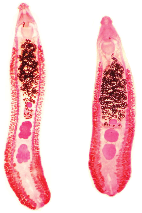 2025 06 04 台湾棘口吸虫Centrocestus formosanus