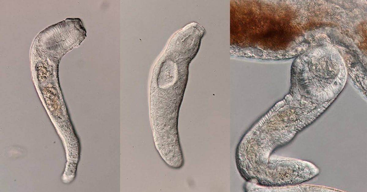 2025 06 04 矮小哈普吸虫Haplorchis pumilio