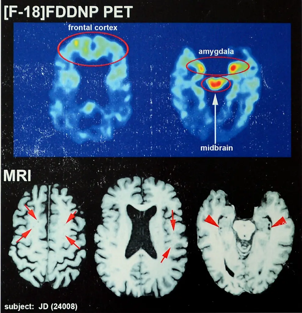 2025 09 26 recent brain scans nfl hall 108927901