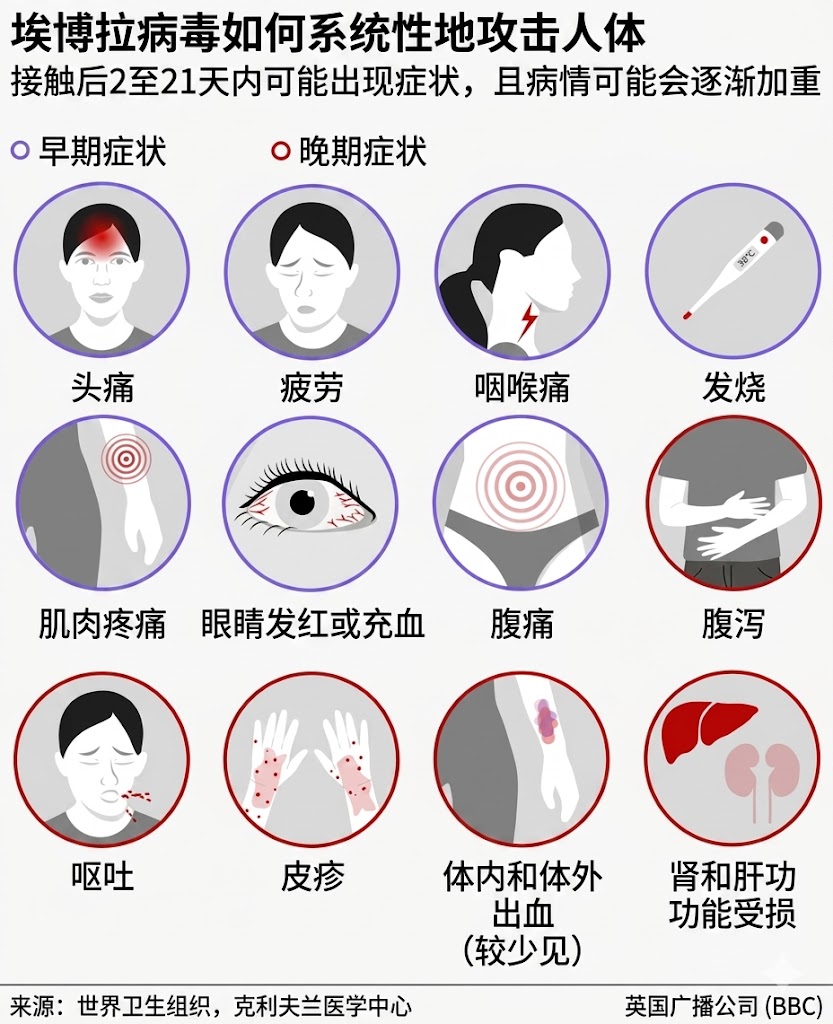 2026 05 21 埃博拉病毒